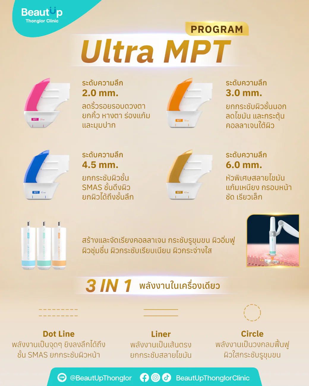 Preview of Online Creative Collection — Ultra MPT 2